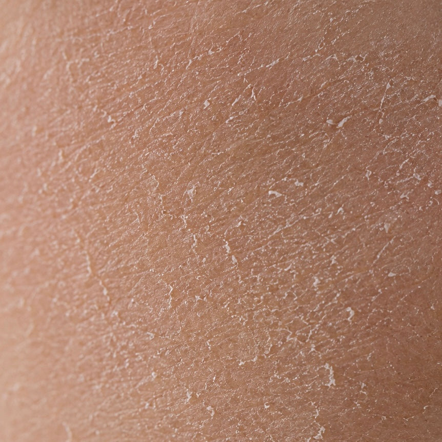 Cosmenia Naturkosmetik für trockene Haut